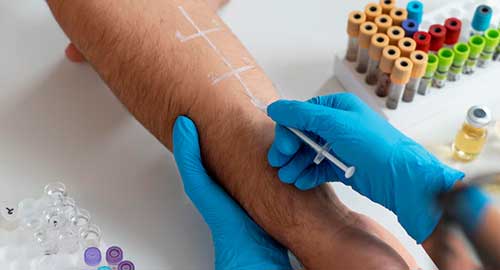 Allergy Screening Test - Advanced