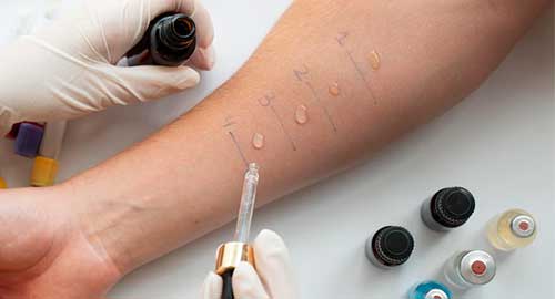 Allergy Screening Test - Comprehensive